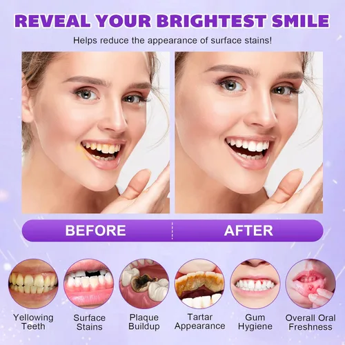 Vista 9 de Polvo blanqueador de dientes – Polvo blanqueador de dientes de nieve con fórmula Pap+, sin peróxido, sin sensibilidad y seguro para el esmalte