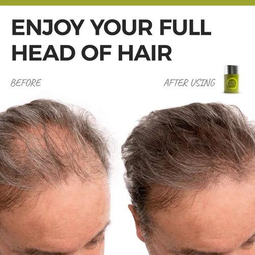 Vista 2 de Fibras capilares para adelgazar el cabello, espray de proteína de queratina natural para engrosar el cabello, fibras capilares para cabello