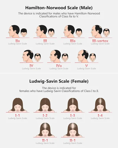 Vista 6 de Terapia de luz roja para el crecimiento del cabello, gorra de crecimiento láser para pérdida de cabello, batería recargable, crecimiento del cabello