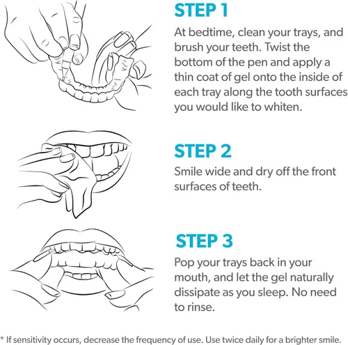 Vista 5 de EverSmile AlignerWhite - Bolígrafo blanqueador de dientes de tamaño viaje con sabor a menta fresca (paquete de 0.1 fl oz), blanqueador de gel