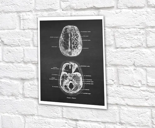 Vista 7 de Neuroscience Art set de 6 impresiones sin marco de anatomía del cerebro humano
